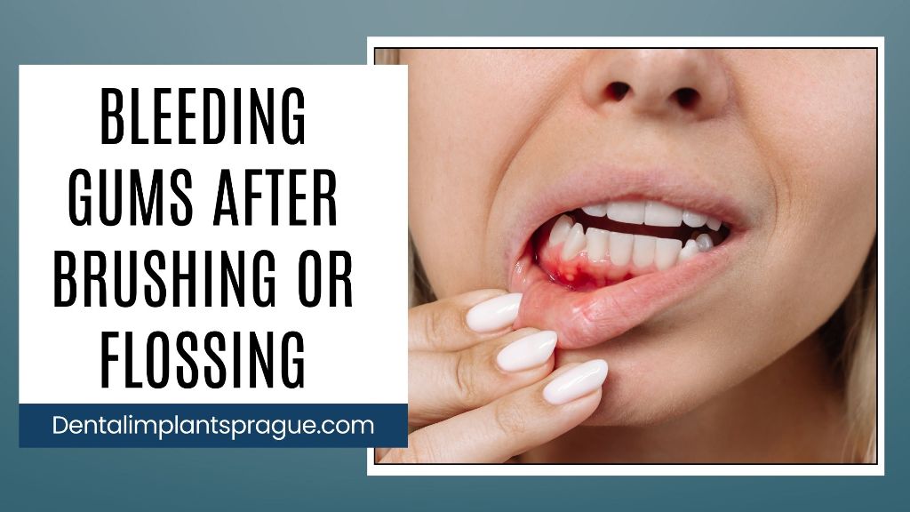 Bleeding Gums After Brushing or Flossing