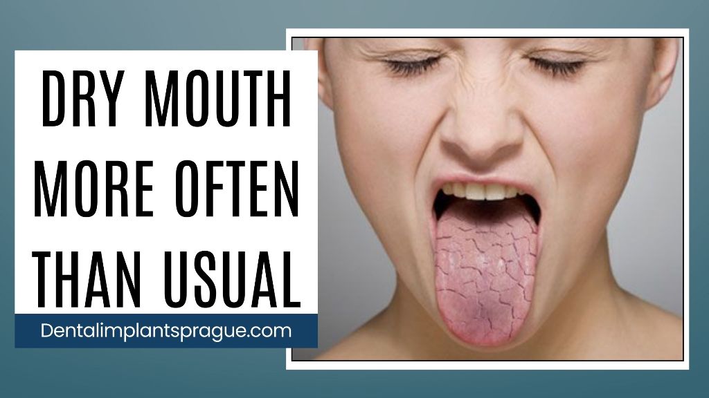 Dry Mouth More Often Than Usual