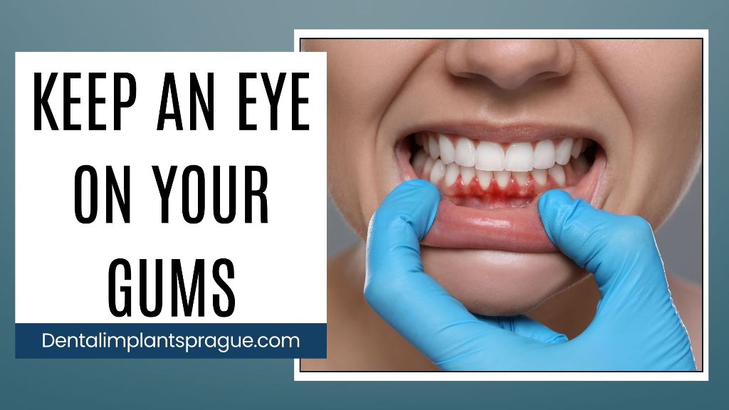 Keep an Eye on Your Gums