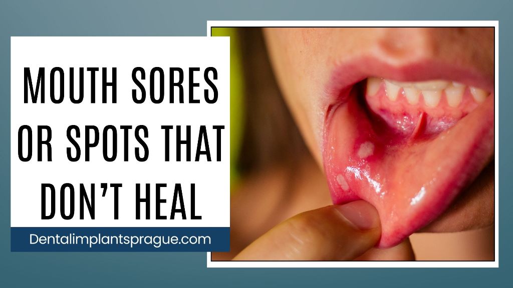 Mouth Sores or Spots That Don’t Heal