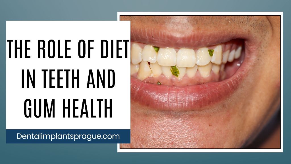 The Role of Diet in Teeth and Gum Health