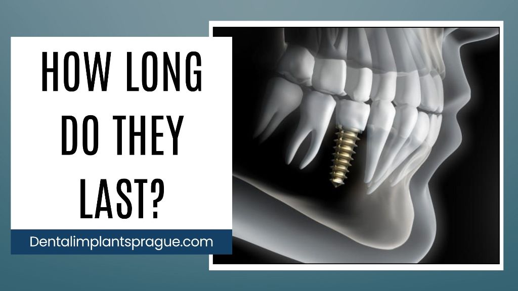 How Long Do They Last