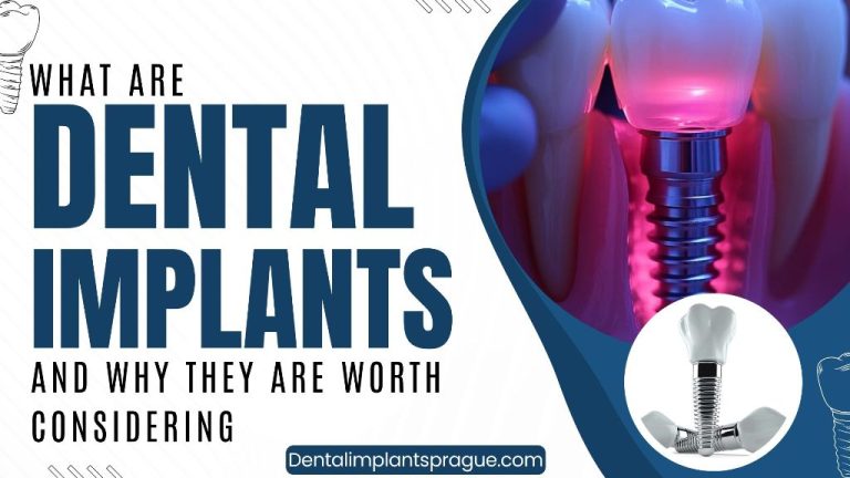 What Are Dental Implants and Why They Are Worth Considering