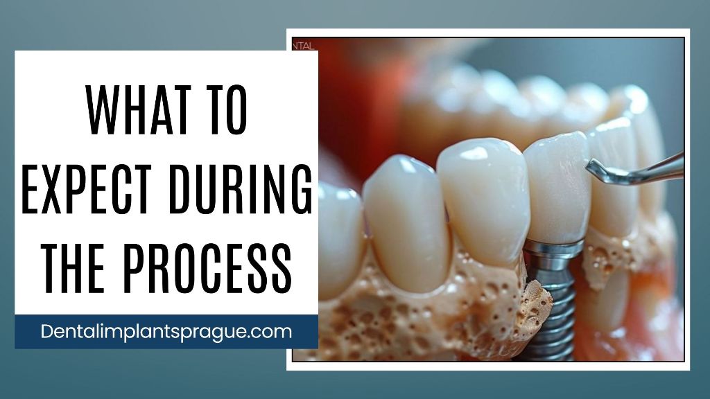 What to Expect During the Process