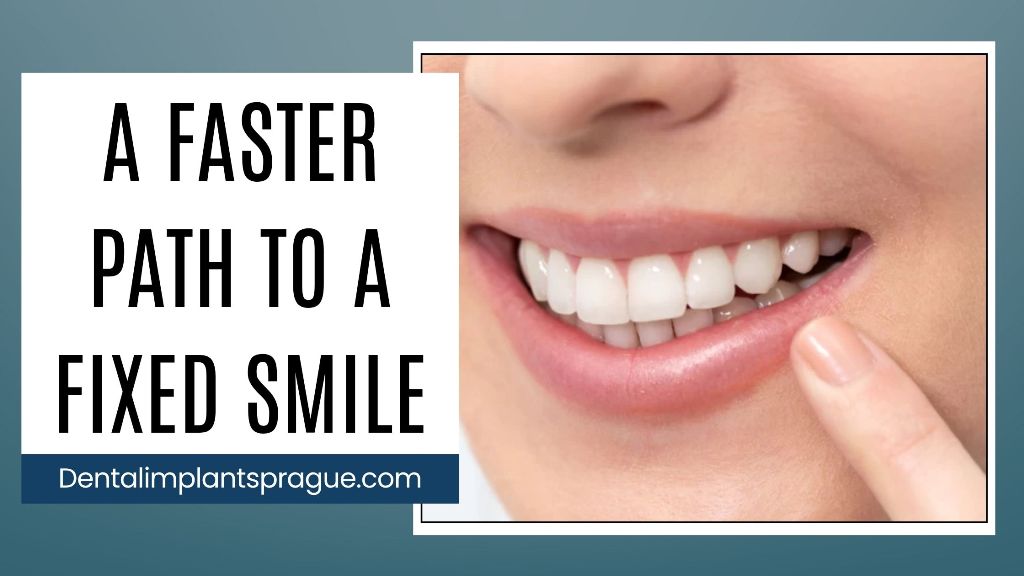 A Faster Path to a Fixed Smile