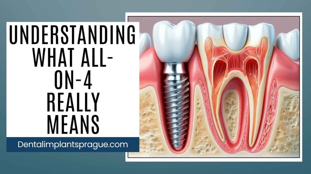 UnderstandingWhatAll-on-4ReallyMeans
