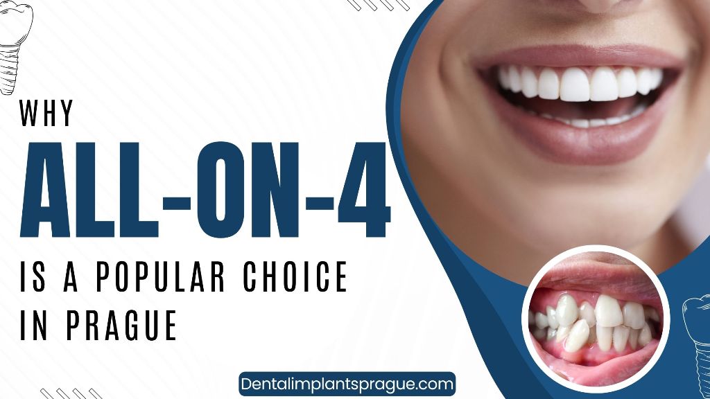 Why All-on-4 Is a Popular Choice in Prague